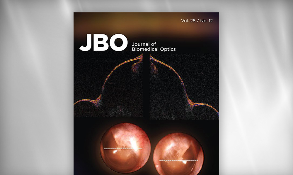 Journal of Biomedical Optics cover from SPIE